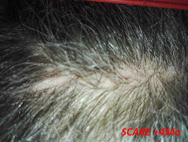 Scare-4mo-5.jpg