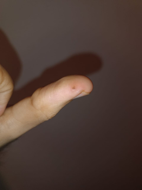 finger-2