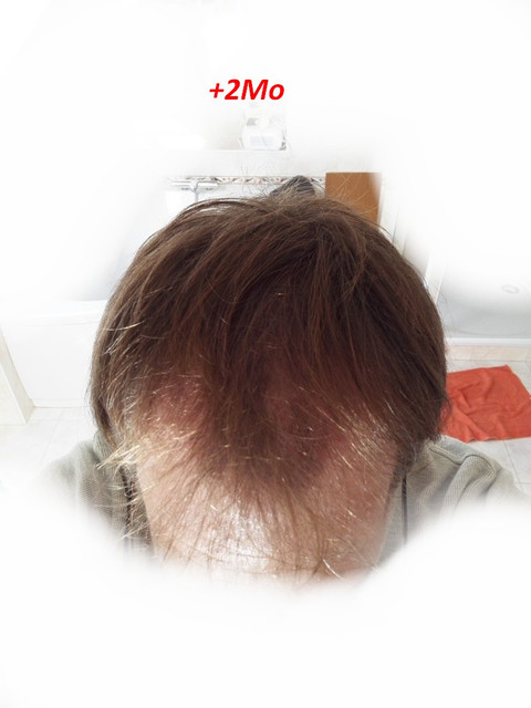 2Mo-1.jpg