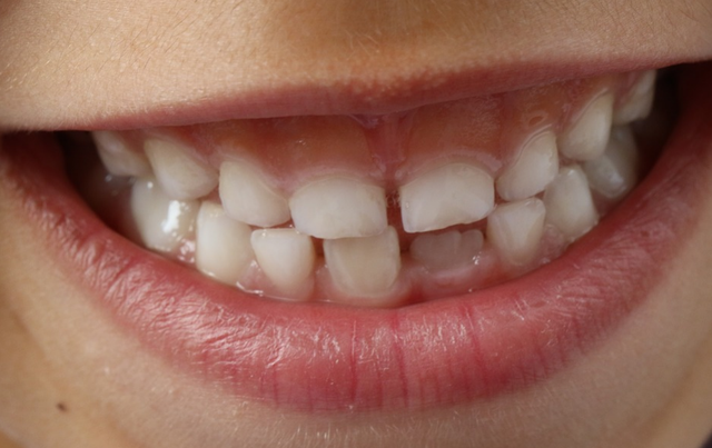 dentist albuquerque nm dentist albuquerque nm