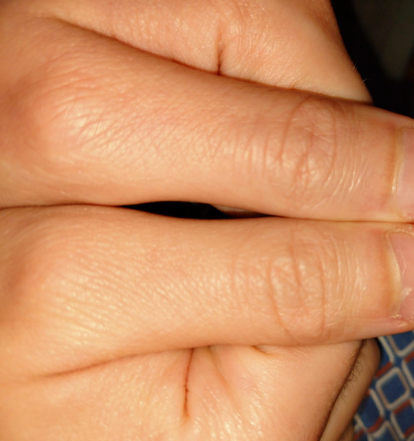 hand 1