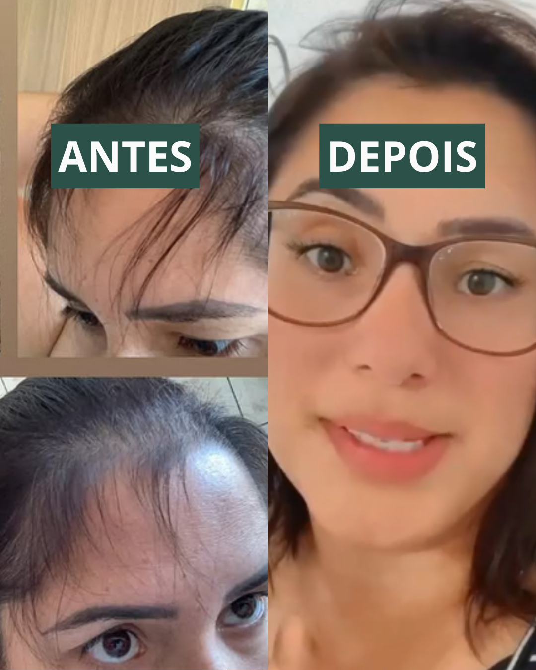 Resultado cliente 1 — Complexo Capilar Primordial Farma
