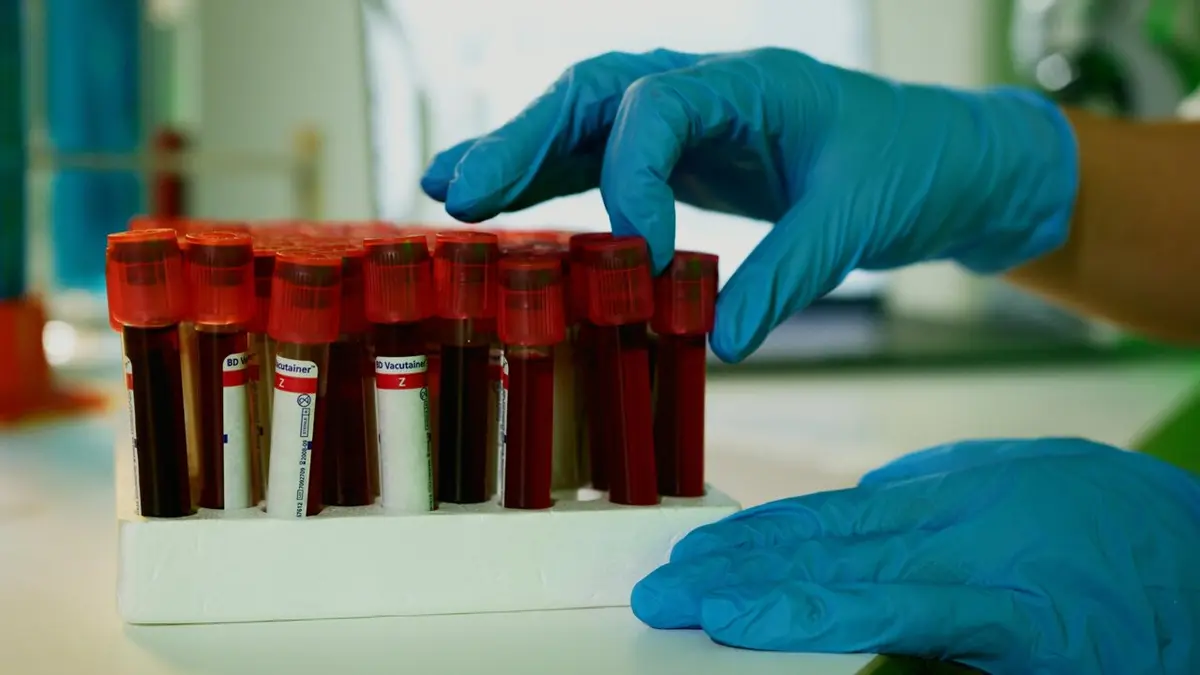 Tumor Cell Neighborhoods Revealed by Blood Test
