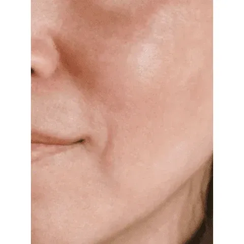Piel después de usar Crystal Skin de SOHO