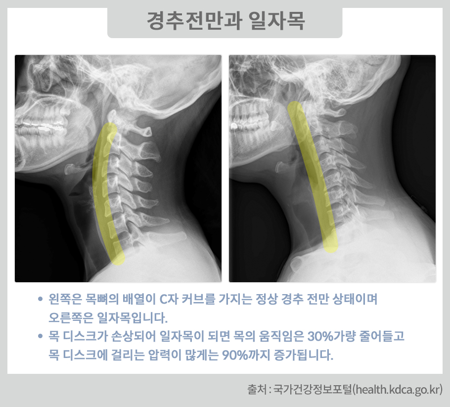 수면 부채의 경제학: 불면증 시대의 생산성 방어 전략