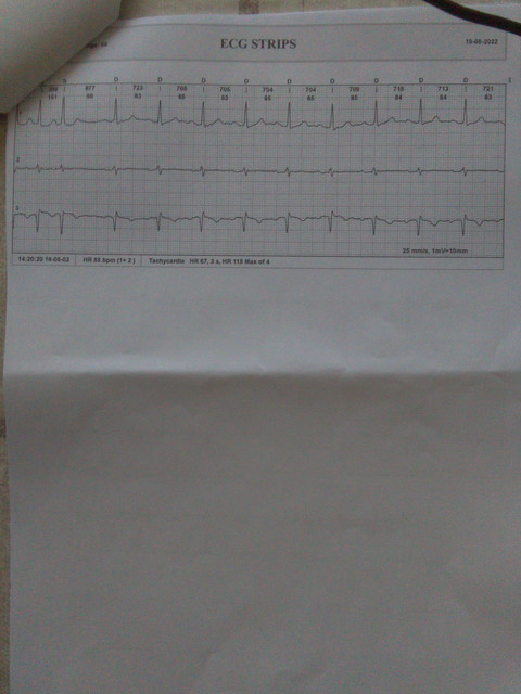 EKG-3