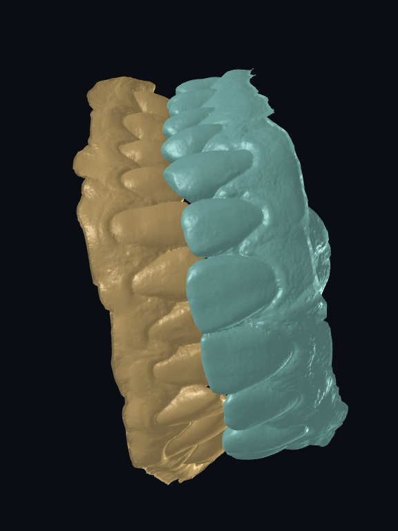 occlusion 4.png