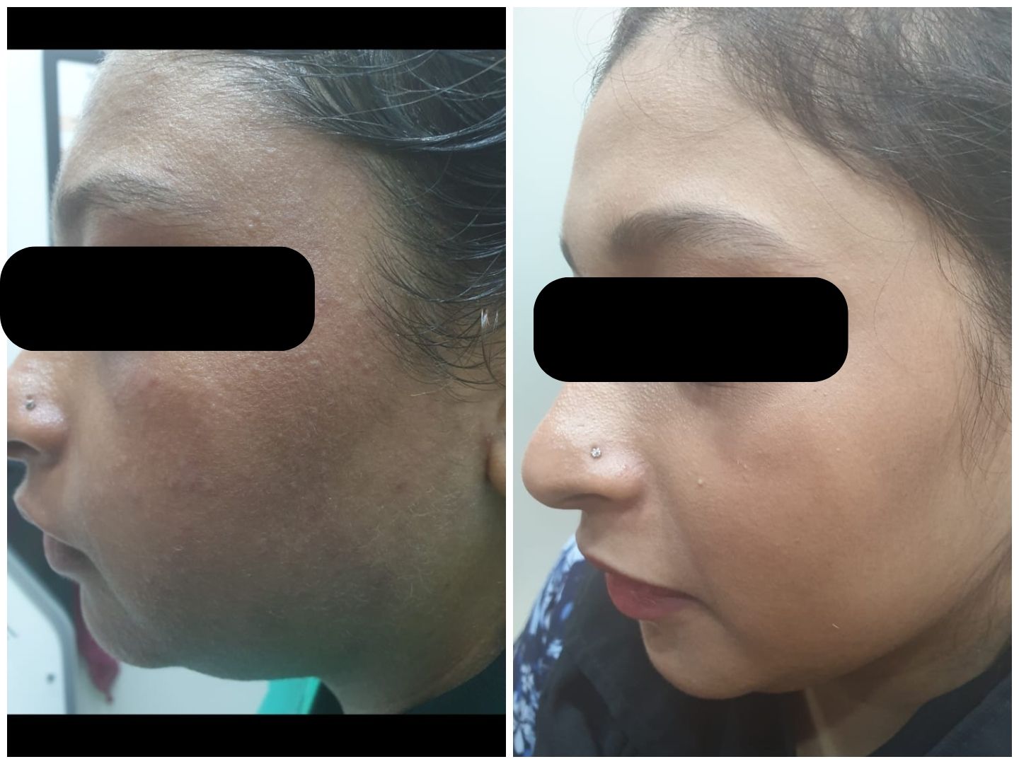 Real patient result