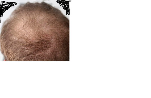 pelo04