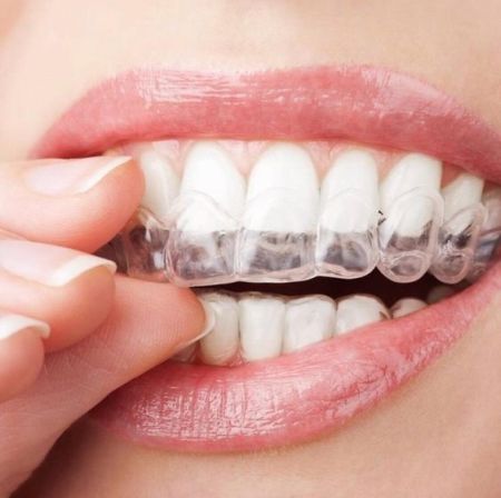 Dentist-Parramatta
