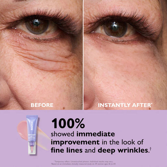 Seurico Instant Lift Eye Gel visible under-eye result