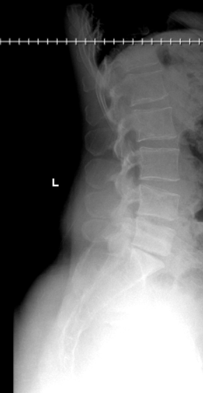 xray4.png