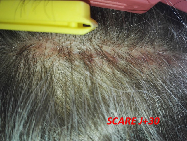 scare-1mo-2.jpg