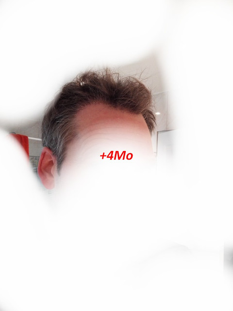 4Mo-5.jpg