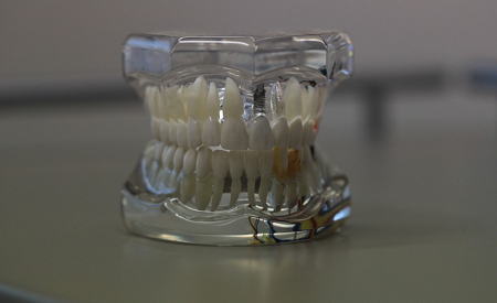 Dentures-Sydney Dentures-Sydney