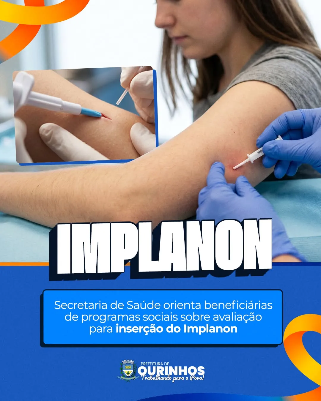 Implanon Foto