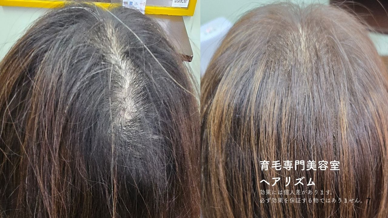 頭皮確認の様子