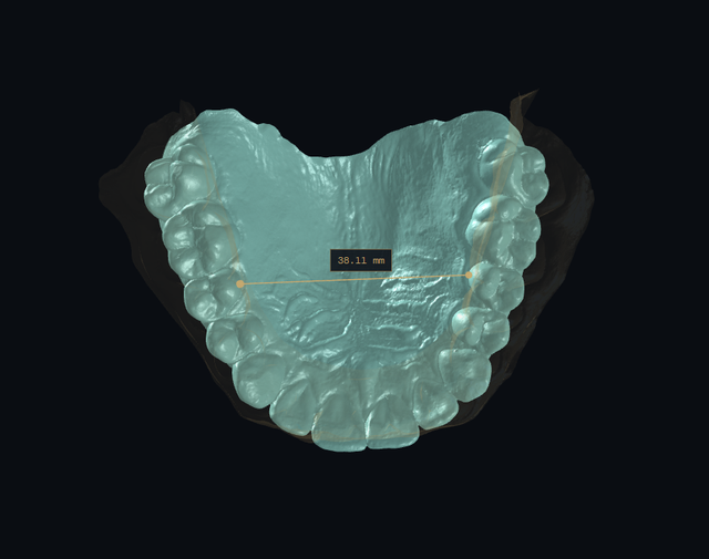 occlusion 10.png