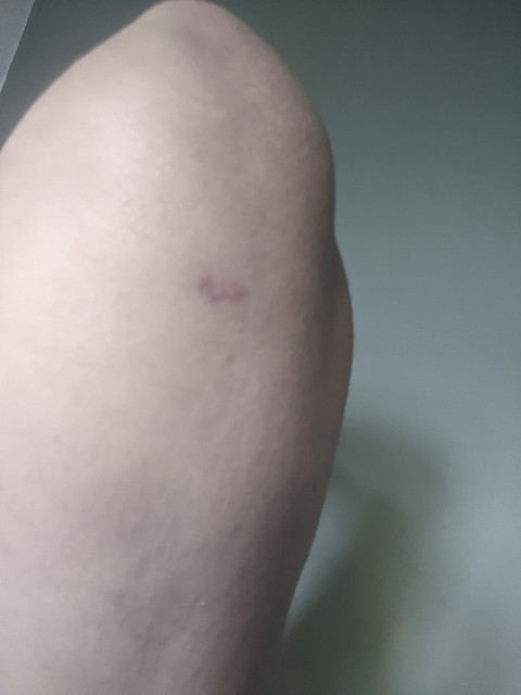 lipo-sc