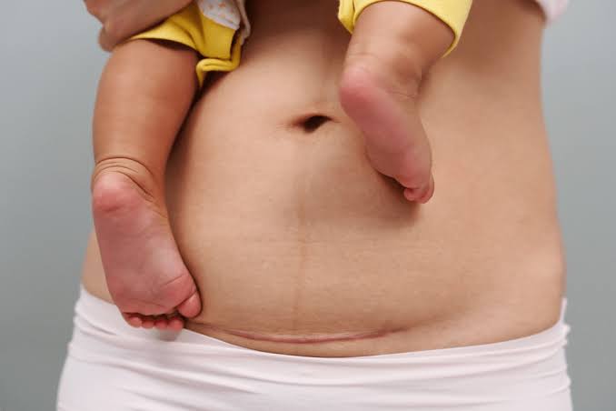 The Silent Stress of Postpartum
