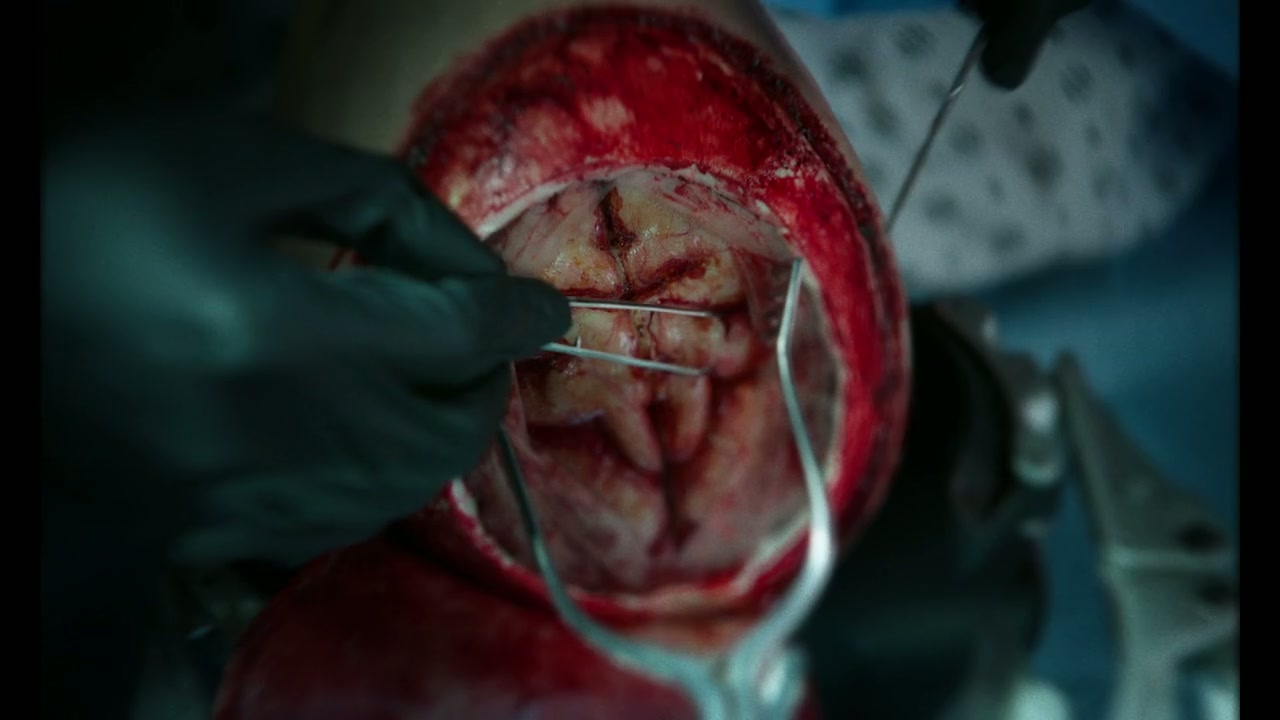 Twisted Screenshot