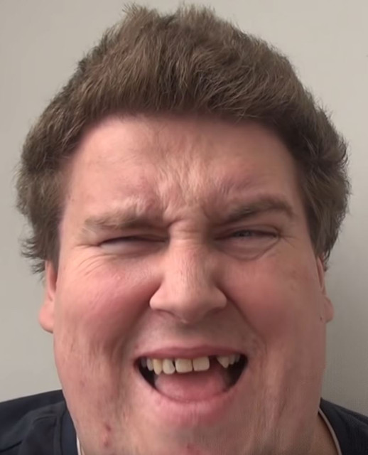 face-11.jpg