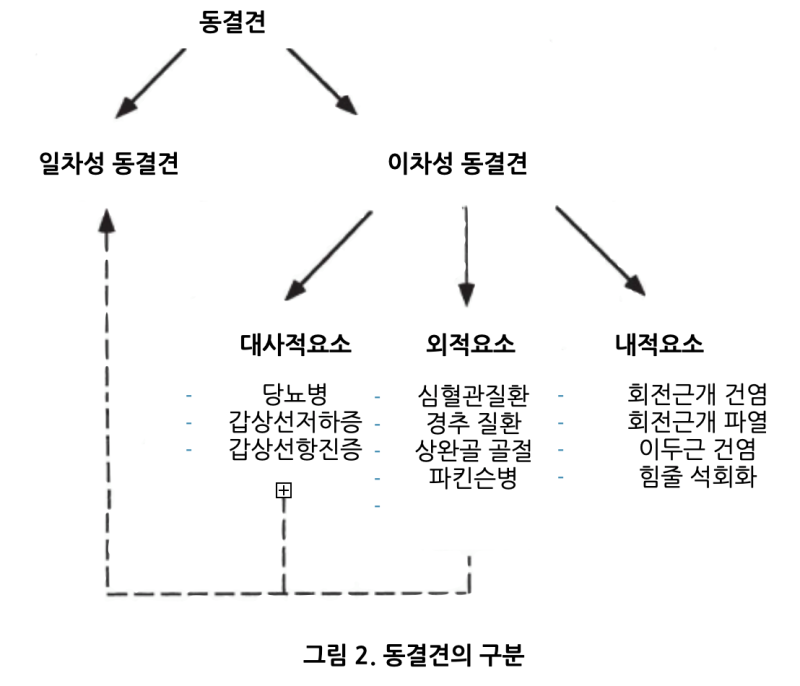 오십견증상 단계별 진행