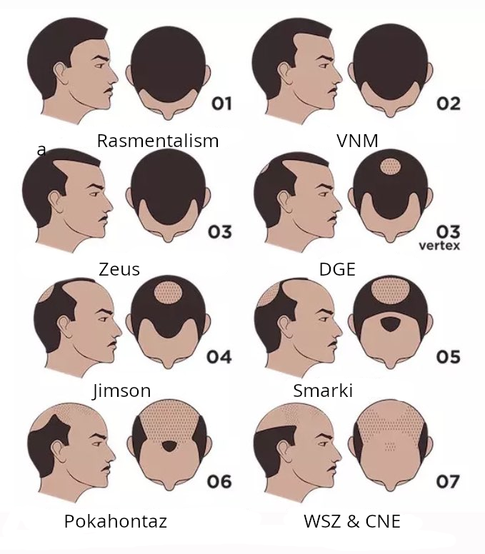 Obrazek