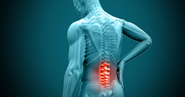Lumbar laminectomy decompression