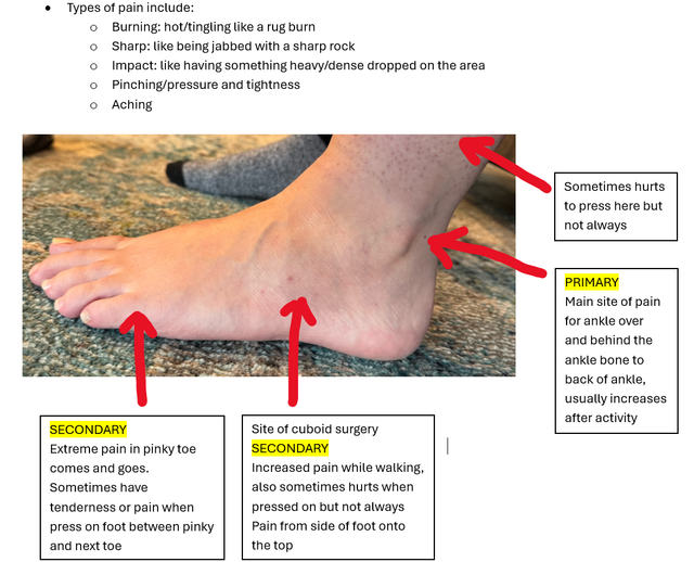 Ankle-details
