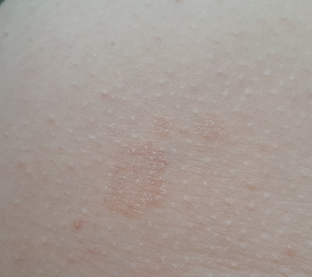 20180810 115148