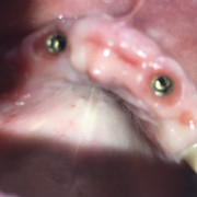 IMG-82fccb12f9a7c93dbdb970fffb48f5ff-V.j