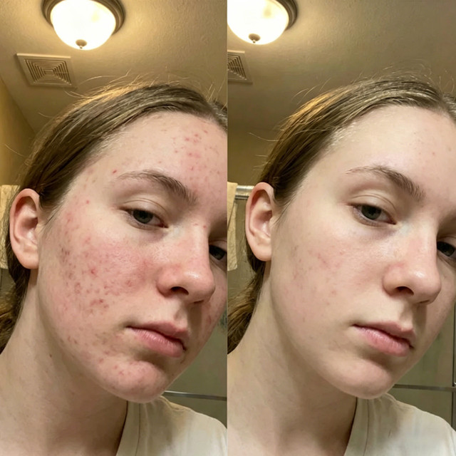 Sarah M before and after result