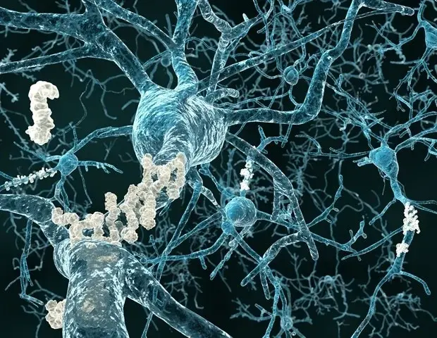 Dopamine Discovery Sheds Light on Alzheimer's Reversal