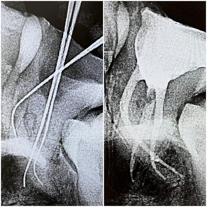 Dental Treatment at DenteGo