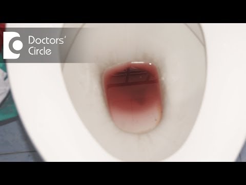 00