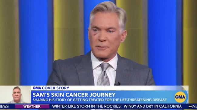 El hombre de 63 años ahora tiene un “gran agujero” en su cara, reveló el viernes.ABC / GMA