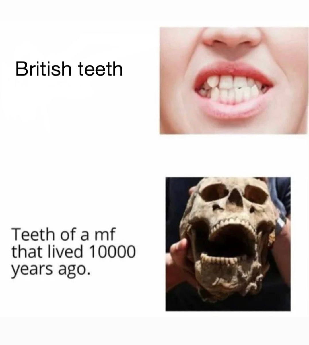 british-teeth-vs.jpg