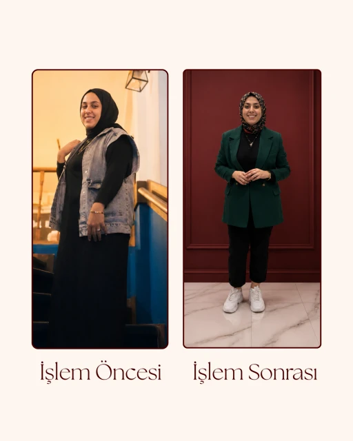 G5 Öncesi Sonrası 1