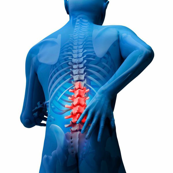 Slip Disc (Disc Herniation)