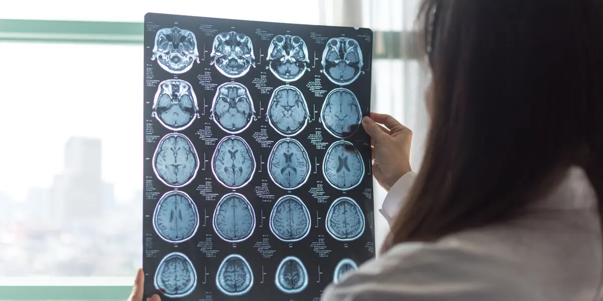 Brain Scans Reveal Link to Aggression in Schizophrenia
