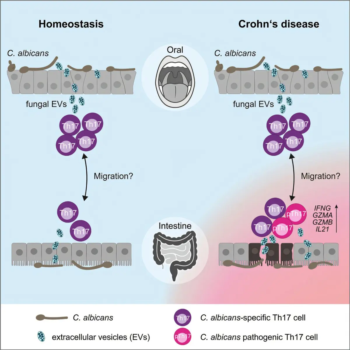 Immune Response to Harmless Yeast Linked to Crohn's Disease