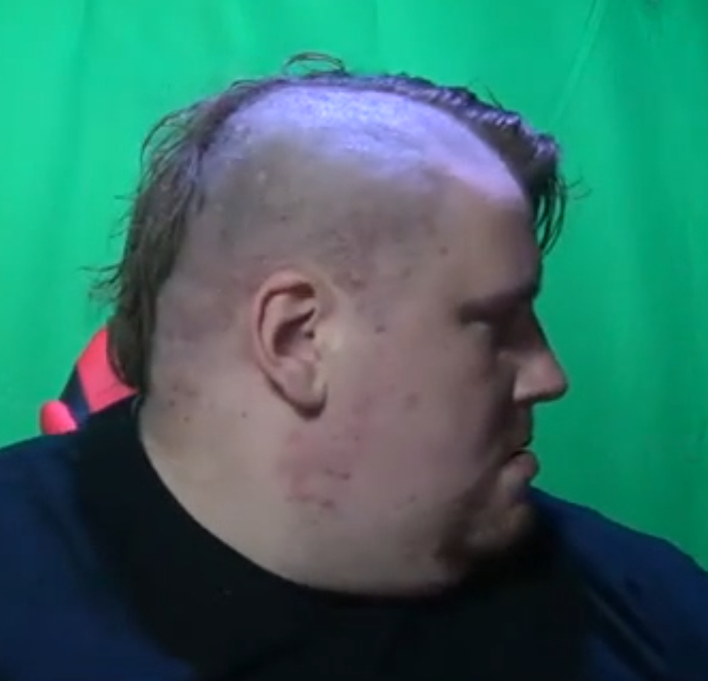 mostkopp41.png