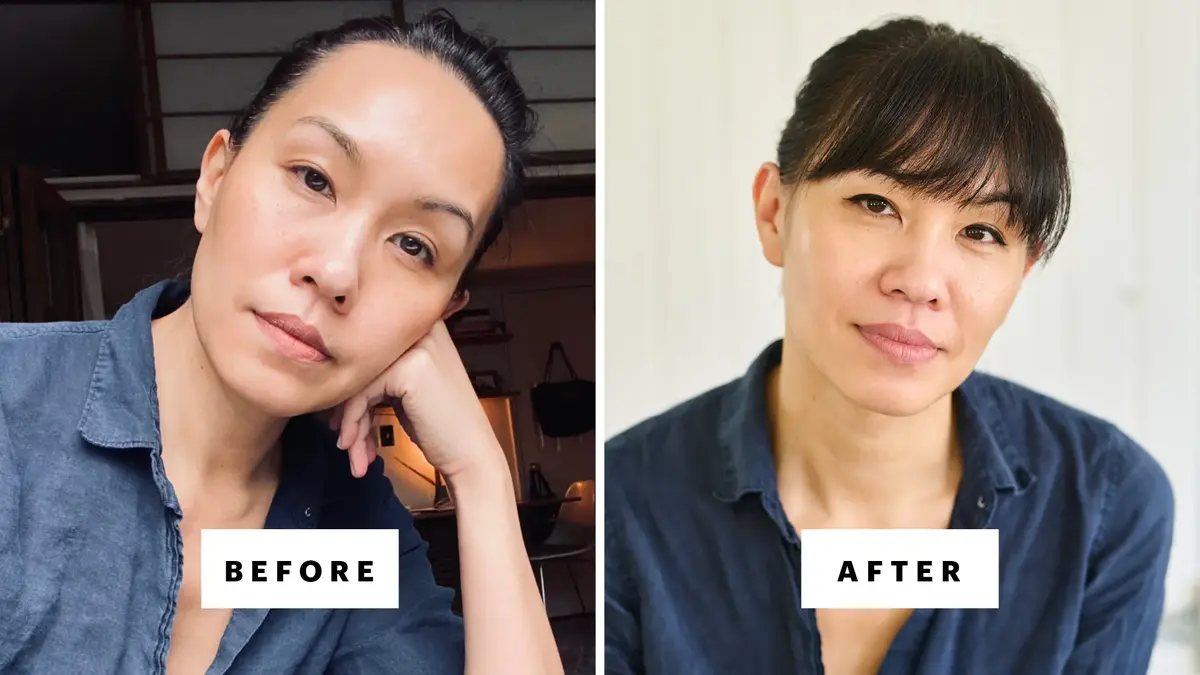A Year Without Cosmetic Treatments