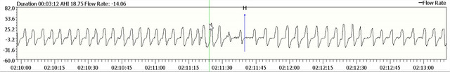 H2-15-12