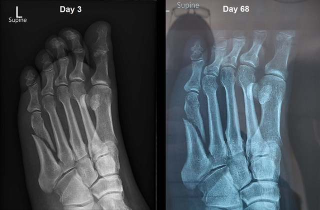 Xray-Comparison