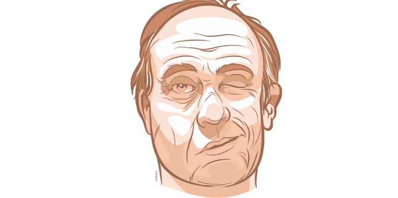Hemifacial Spasm