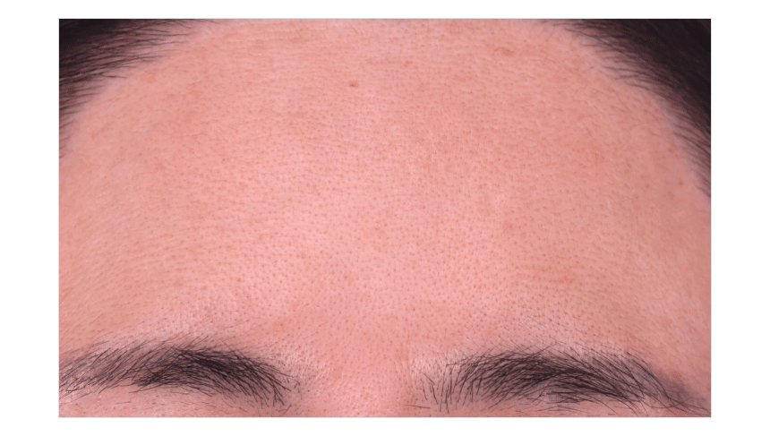 Multi Collagen Wrinkle Balm 01 06