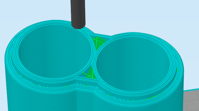 Insulin-Holder-Print-Jittering-Example
