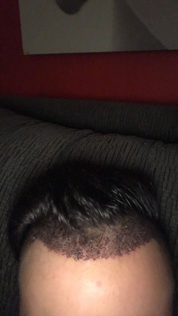 IMG 2564